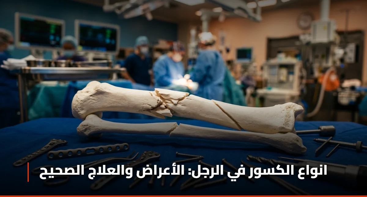 انواع الكسور في الرجل