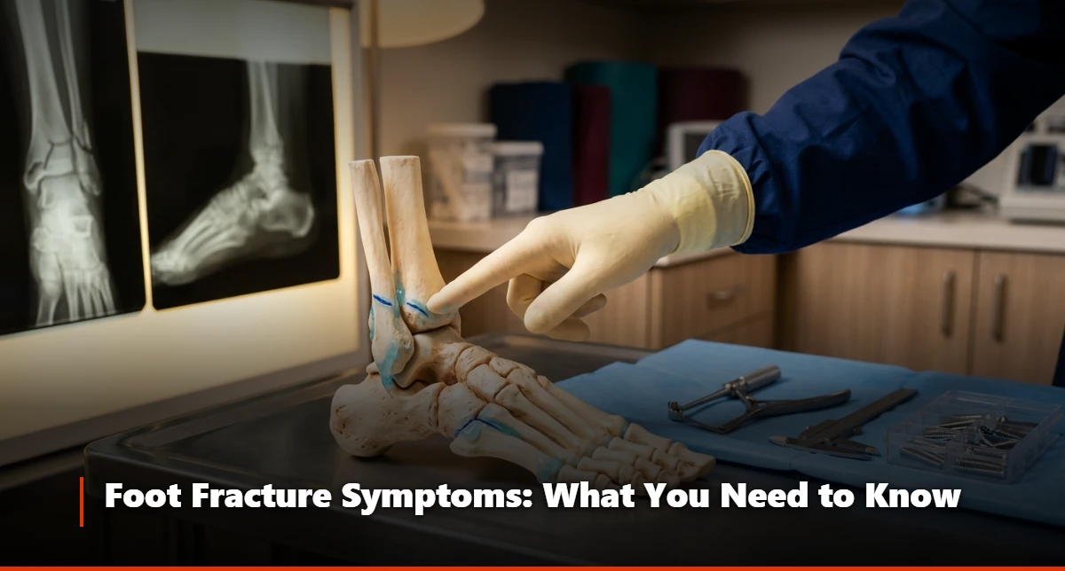 Broken Foot Symptoms