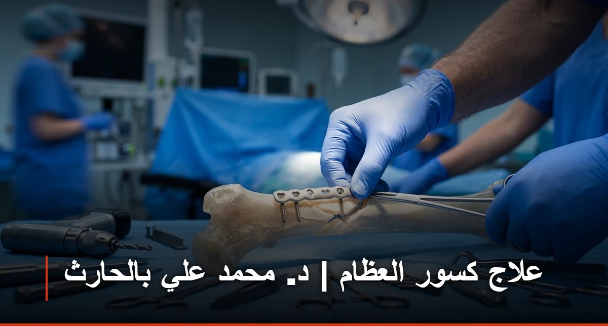 علاج كسور العظام