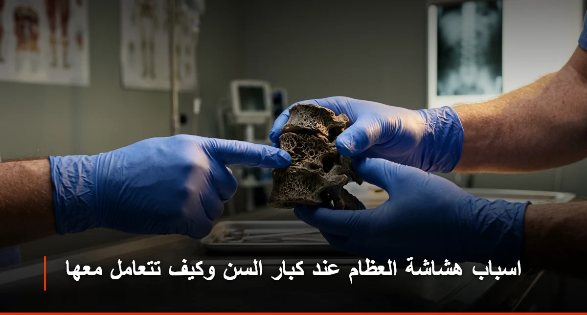 اسباب هشاشة العظام عند كبار السن